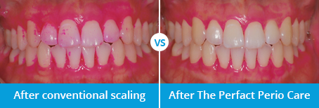 ENG10-Oral-Hygiene_11